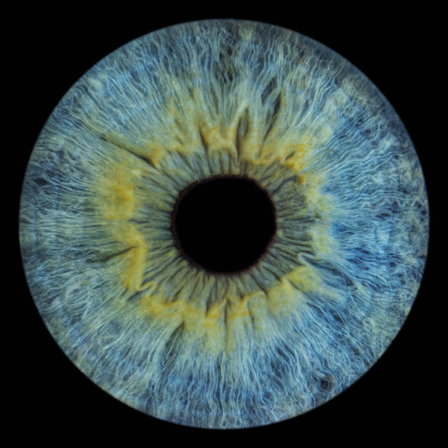 A pale ice-blue iris flecked with gold